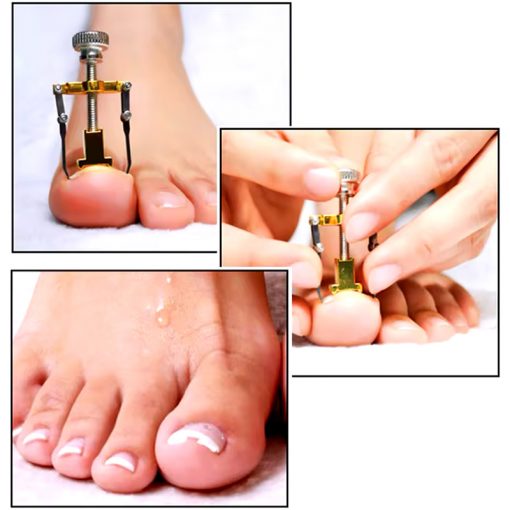 دستگاه اصلاح فرم و ارتودنسی ناخن مدل Nails