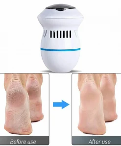 سنگ پا تخم مرغی callus remover