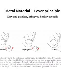 دستگاه اصلاح فرم و ارتودنسی ناخن مدل Nails