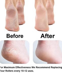 سنگ پا برقی شارژی pretty gril foot مدل 43082 - 3