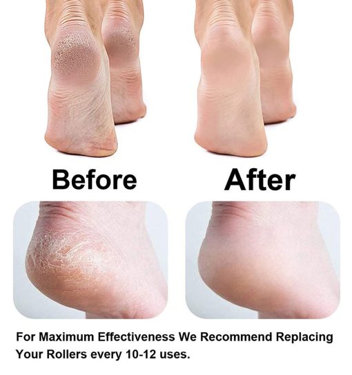 سنگ پا برقی شارژی pretty gril foot مدل 43082 - 3