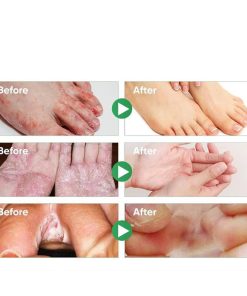 اسپری گیاهی ضدبو و درمان زخم پا حجم 30 میلی لیتر