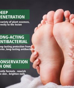 اسپری گیاهی ضدبو و درمان زخم پا حجم 30 میلی لیتر