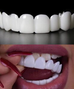 لمینت دندان دو فک مدل Snap on Smile