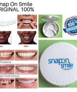 لمینت دندان دو فک مدل Snap on Smile